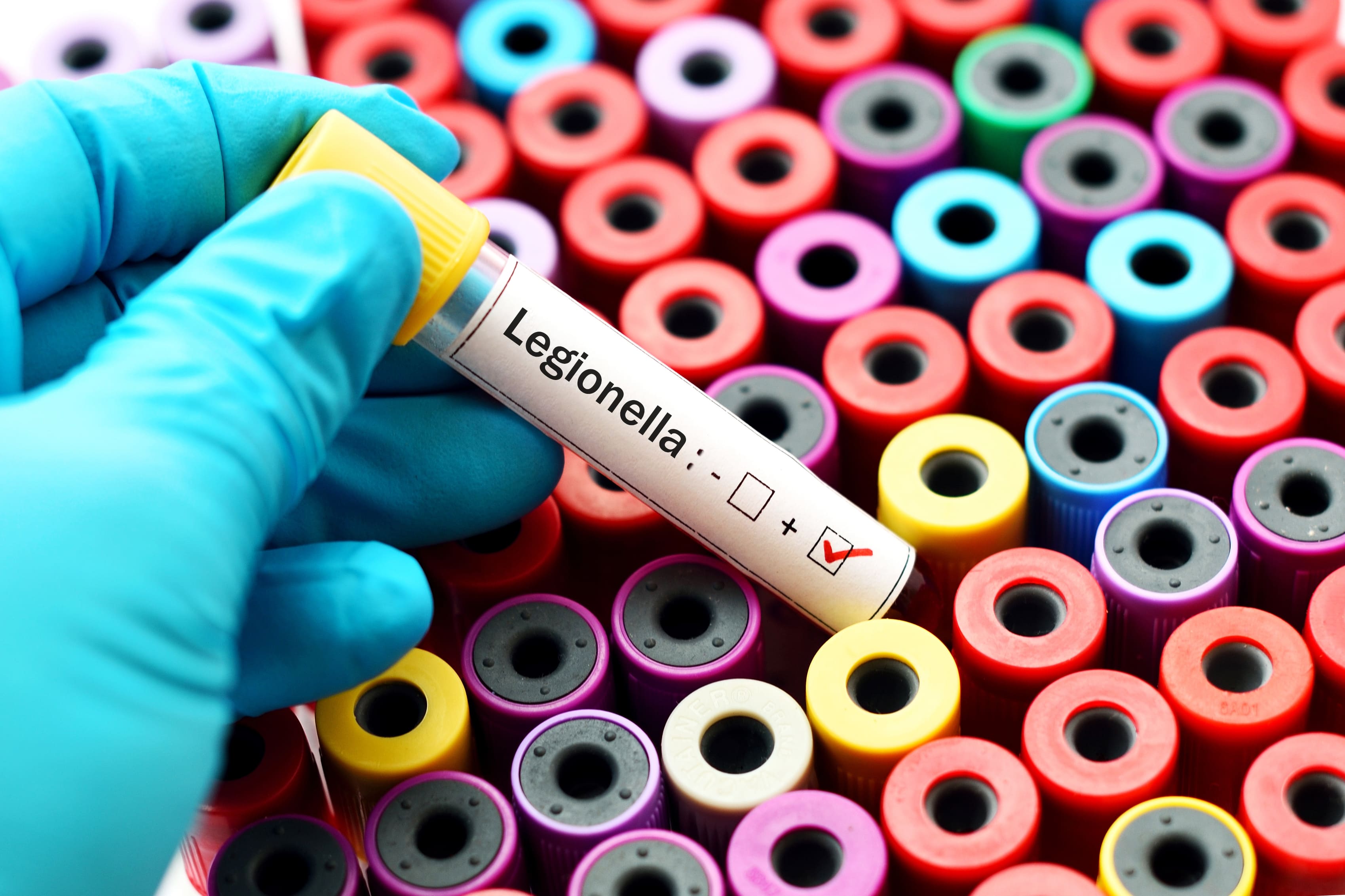 legionella beheersplan