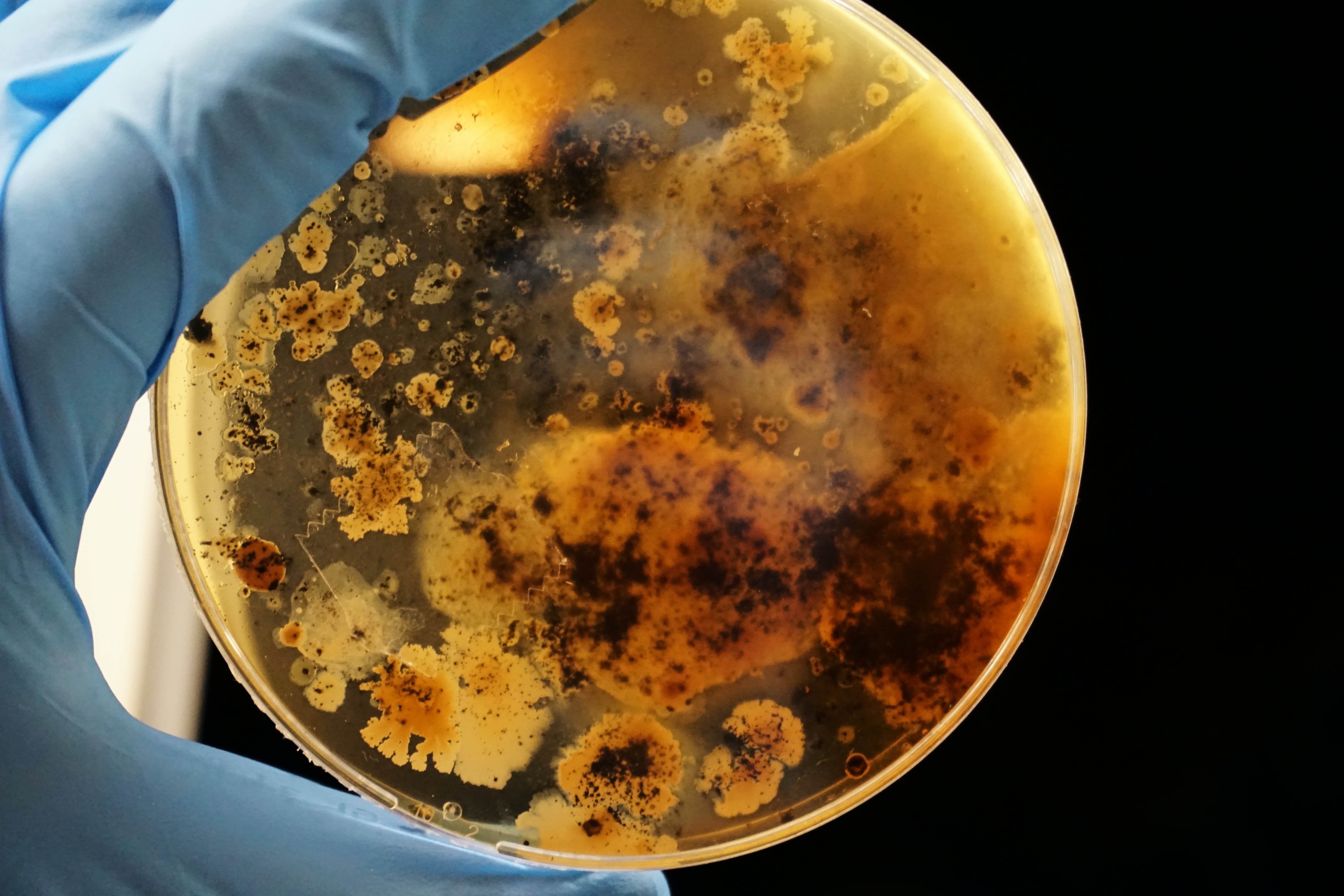 Legionella bacterie